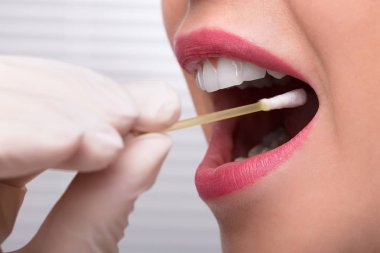 Dişçi el ile pamuklu çubukla kadın ağzından tükürük testi alarak