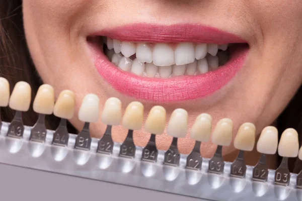 Primer Plano Una Mujer Sonriente Sosteniendo Conjunto Implantes Con Varios — Foto de Stock