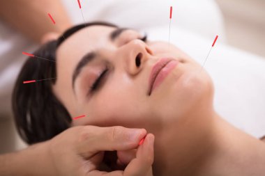 Güzel genç kadın güzellik Spa akupunktur tedavi görüyor