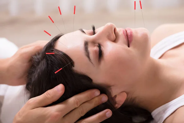 Ontspannen Jonge Vrouw Acupunctuur Behandeling Krijgen Beauty Spa — Stockfoto