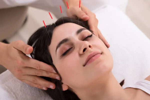 Ontspannen Jonge Vrouw Acupunctuur Behandeling Krijgen Beauty Spa — Stockfoto