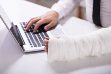 Kırık El Laptop Resepsiyon üzerinde kullanarak bir adamla Close-up