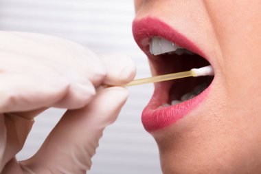 Dişçi el ile pamuklu çubukla kadın ağzından tükürük testi alarak