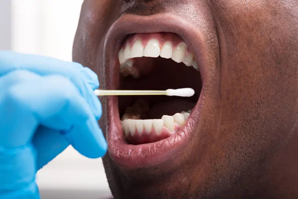 Close Dentista Vestindo Dentes Limpeza Luva Azul Com Botões Algodão — Fotografia de Stock