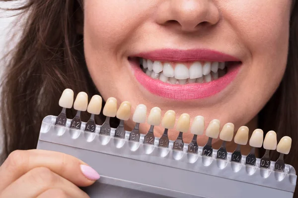 Close Smiling Woman Holding Set Implants Various Shades Tone — Stock Photo, Image