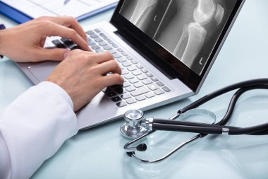 Doktor el diz X-ray stetoskop ile Laptop Resepsiyon üzerinde incelenmesi