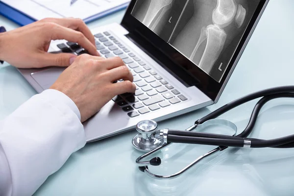 Läkarens Hand Undersöka Knä Röntgen Laptop Med Stetoskop Över Skrivbord — Stockfoto
