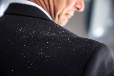 Bir işadamı ile kepek onun omzuna yakın çekim