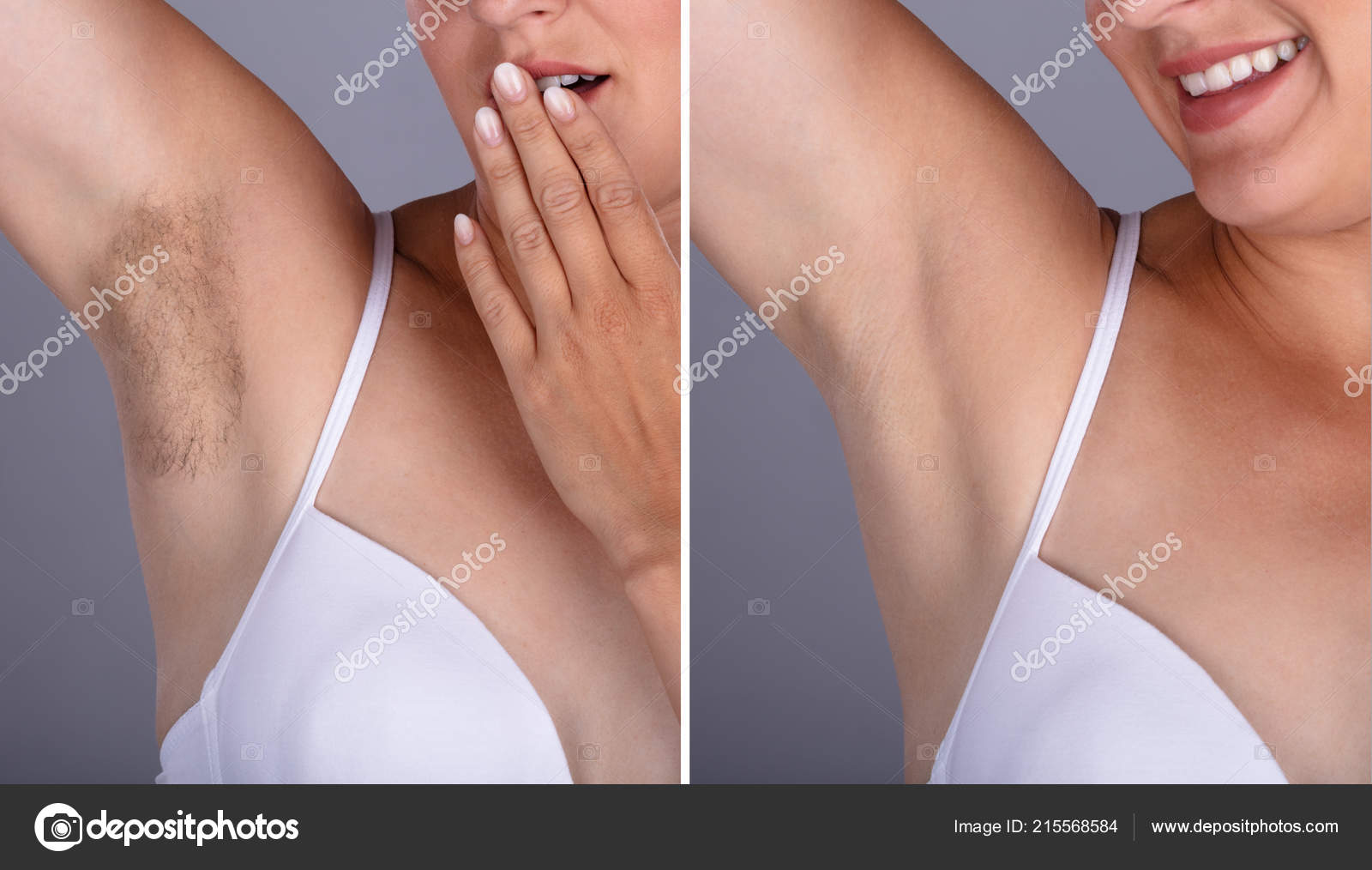 Concept Woman's Underarm Hair Removal Grey Background Stock Photo by  ©AndreyPopov 215568584