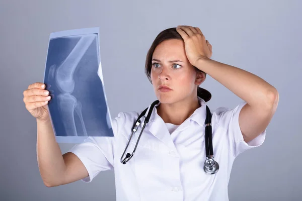 Shocked Doctor Femenino Examinando Radiografía Rodilla Sobre Fondo Gris — Foto de Stock