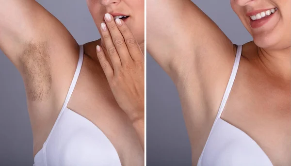 Do models shave or wax their arms?