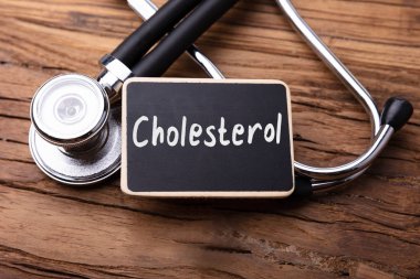 Cholesterol Word Written On Slate With Stethoscope On Wooden Table clipart