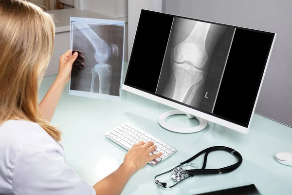 Närbild Kvinna Läkare Undersöka Knä Röntgen Klinik — Stockfoto