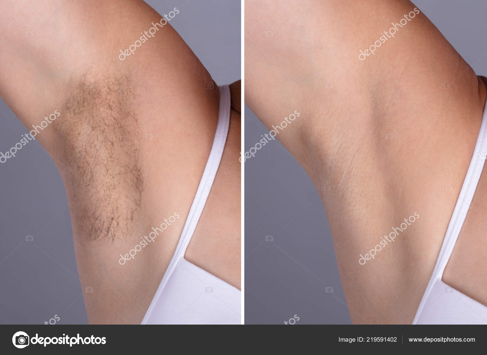 Concept Woman's Underarm Hair Removal Grey Background Stock Photo by  ©AndreyPopov 219591402