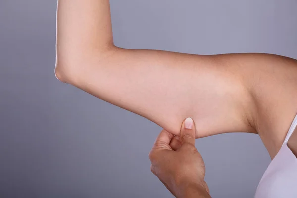 Close Woman Holding Arm Excess Fat Grey Background — Stock Photo, Image