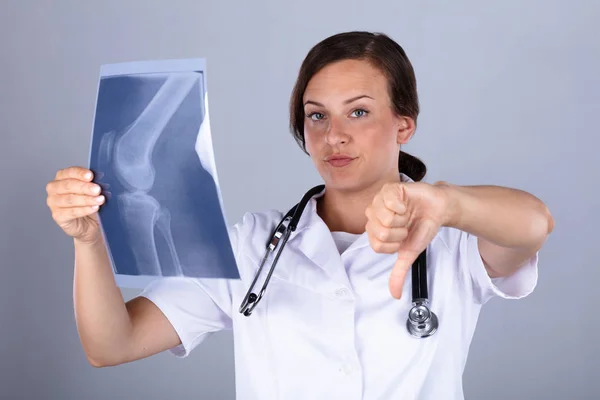 Retrato Una Joven Doctora Con Rodilla Rayos Gestos Pulgares Hacia — Foto de Stock