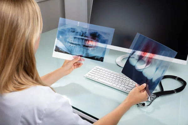 Nahaufnahme Einer Zahnärztin Beim Röntgen Der Zähne Der Klinik — Stockfoto