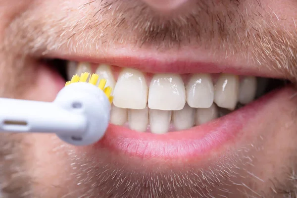 Крупный План Человека Чистящего Зубы Электрической Щеткой — стоковое фото