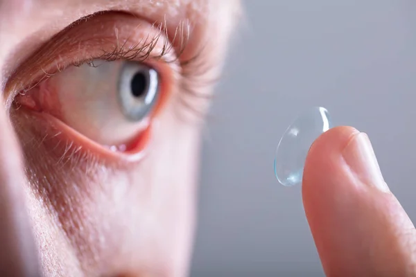 Close-up Of Man Wearing Contact Lens In His Eye