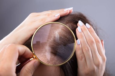 Dermatolog'ın el kadın saçı büyüteç ile incelenmesi