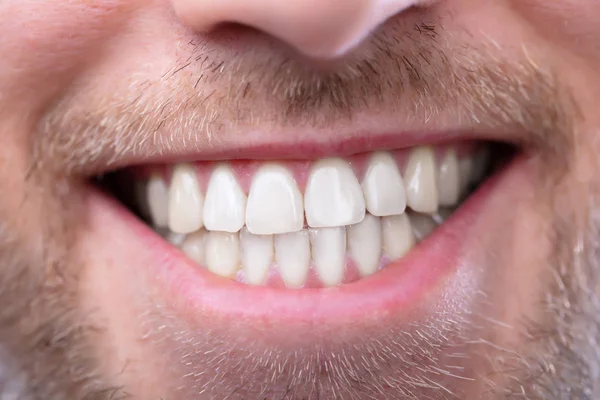 Zbliżenie Szczęśliwego Mężczyzny Zdrowymi Zębami — Zdjęcie stockowe