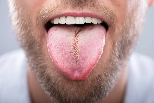 Primer Plano Hombre Mostrando Lengua — Foto de Stock