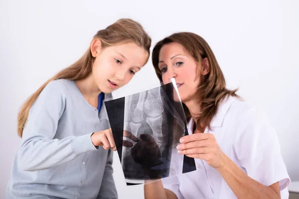 Kız Olgun Kadın Doktor Holding Kemik Ray Yakın Çekim — Stok fotoğraf