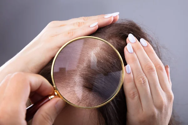 Dermatólogo Mano Examinando Cabello Mujer Con Lupa — Foto de Stock