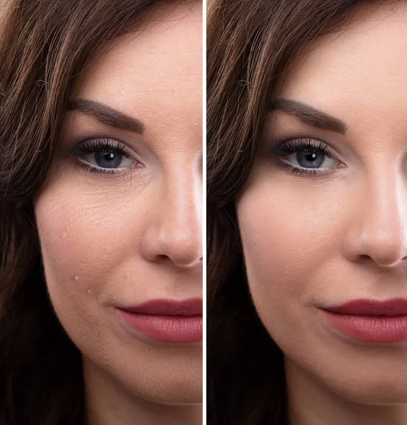 Portrait Of A Young Woman's Face Before And After Cosmetic Procedure