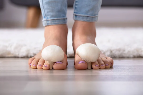 一个女人的脚与脚趾之间的可食用蘑菇特写 — 图库照片