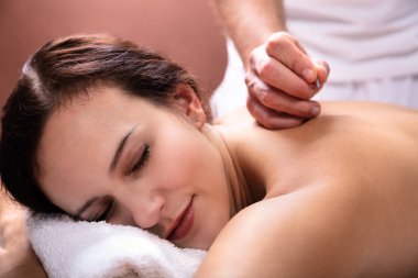 Akupunktur tedavi Spa geçmekte rahat genç kadın Close-up