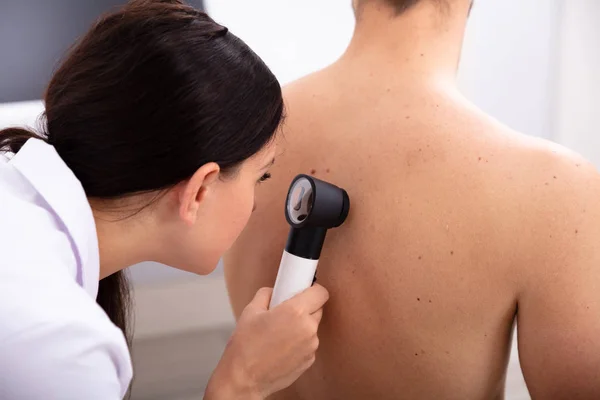 Kobieta Lekarz Badanie Pigmented Skóry Plecach Człowieka Dermatoskopem — Zdjęcie stockowe
