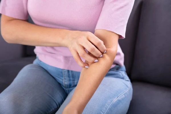 Close Van Een Vrouw Hand Krassen Jeuk Haar Arm — Stockfoto