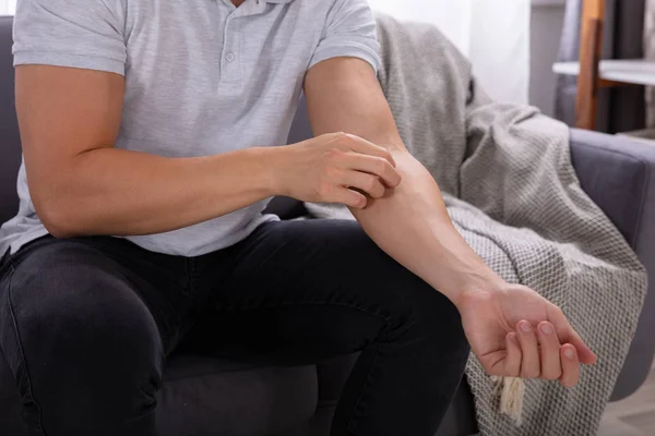 Visão Meio Homem Sentado Sofá Sofrendo Coceira — Fotografia de Stock