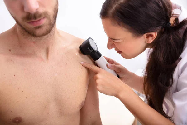 Close Doctor Checking Acne Male Patient Dermatoscope — Stock Photo, Image