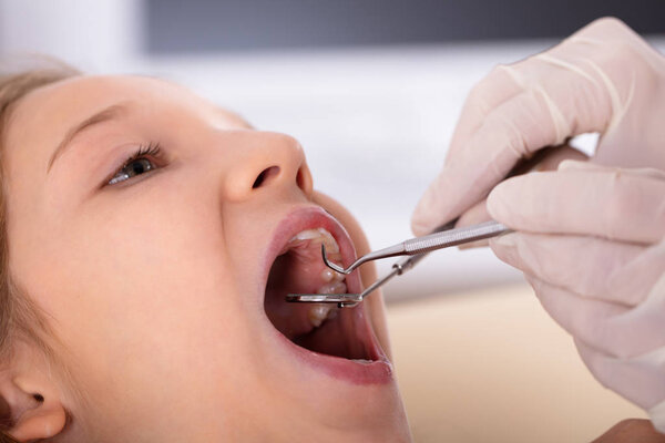 Крупный план девушки, проходящей стоматологическое лечение в клинике
