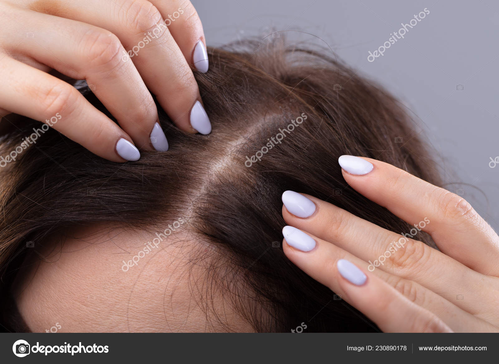 Close Woman Thinning Hair Head Stock Photo C Andreypopov 230890178