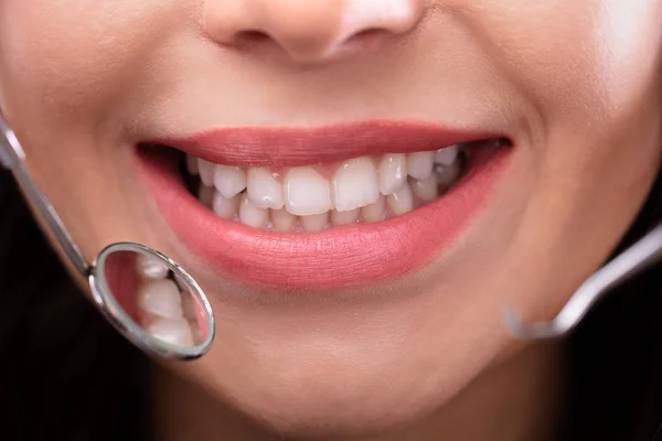 Dentista Examinando Dentes Com Espelho Dental Escalador — Fotografia de Stock