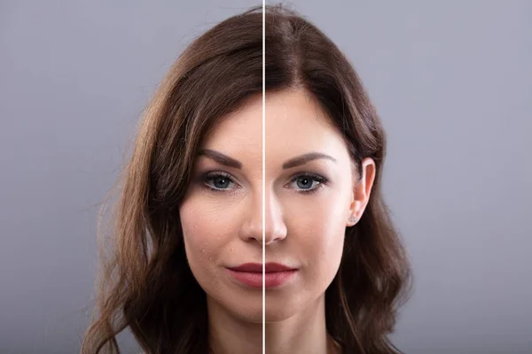 Retrato Rosto Uma Jovem Mulher Antes Depois Procedimento Cosmético — Fotografia de Stock