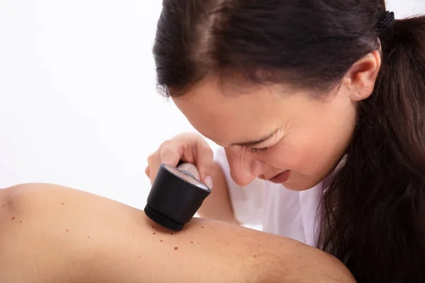 Médico Femenino Examinando Piel Del Paciente Masculino Con Dermatoscopio Clínica — Foto de Stock