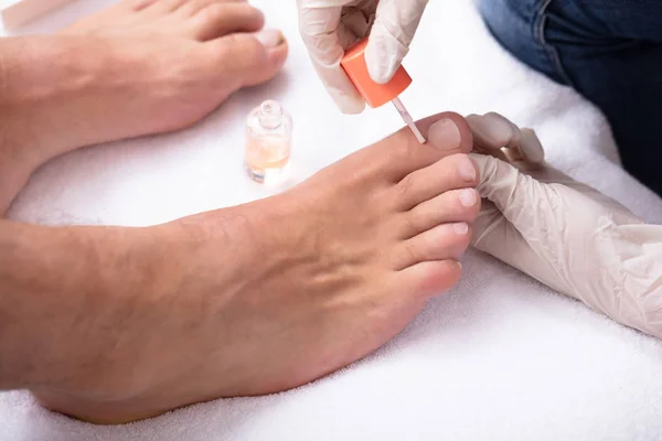 男性の足に保湿ネイルオイルを適用するマニキュリスト手のクローズアップ — ストック写真