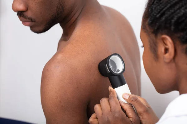 Zbliżenie Kobiety Lekarz Sprawdzanie Pigmentu Skóry Plecach Człowieka Dermatoskopem — Zdjęcie stockowe