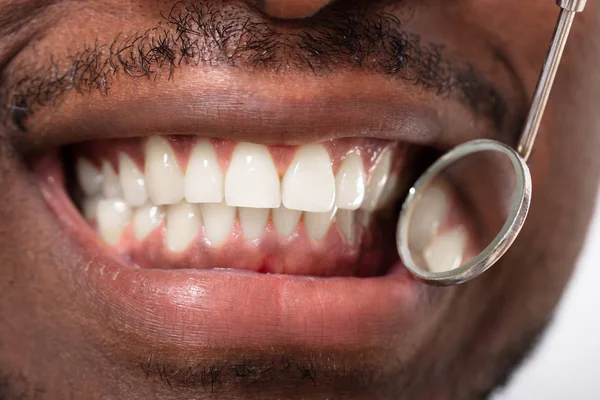 Paciente Masculino Sendo Verificado Pelo Dentista Com Espelho Dental Escalador — Fotografia de Stock