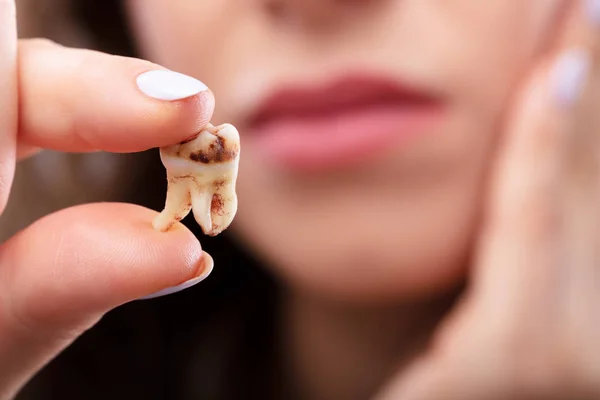 Close Woman Hand Holding Decay Tooth — Stock Photo, Image