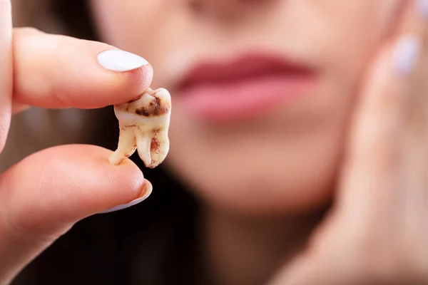 Close Mão Uma Mulher Segurando Dente Decadência — Fotografia de Stock