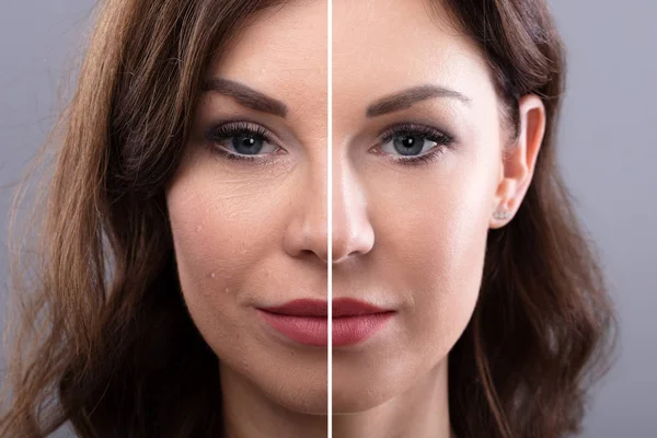 一个年轻女性的脸的肖像之前和之后的化妆品程序 — 图库照片