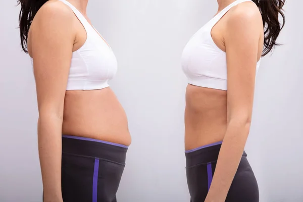 Vista Lateral Antes Depois Conceito Mostrando Gordura Para Mulher Magro — Fotografia de Stock