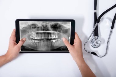 Doktor Holding dijital tablet insan dişleri ile yakın çekim x-ışını ve beyaz arka plan üzerinde stetoskop