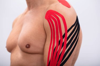 Injured Man Having Red And Black Physio Therapy  Tape On His Arms clipart