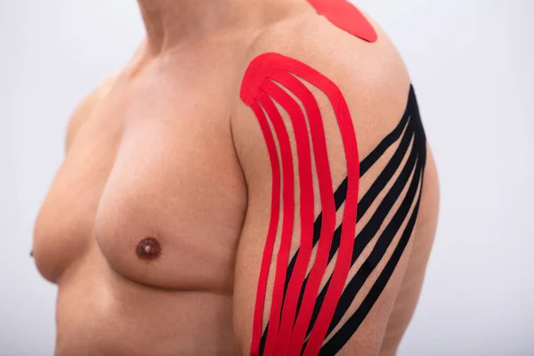 Injured Man Having Red Black Physio Therapy Tape His Arms — Stock Photo, Image